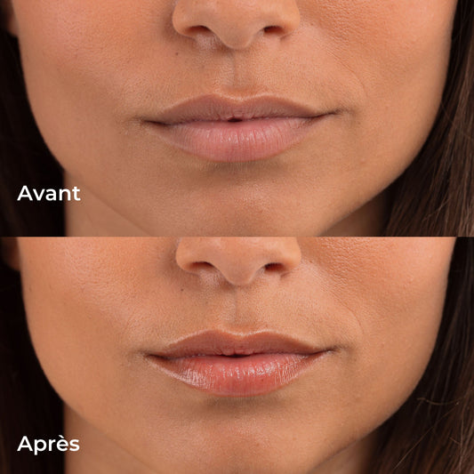 Les Petits Prödiges Tinted Lip Balm – 10 ml